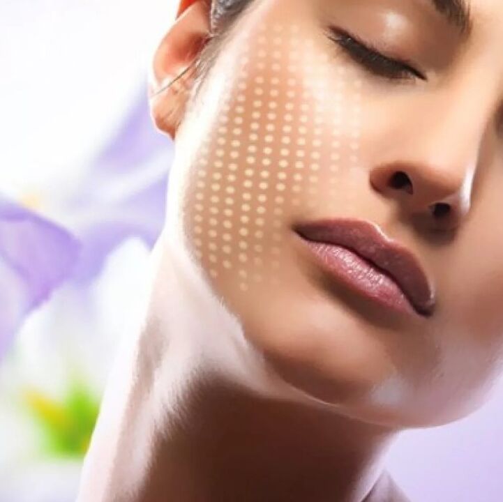 Laser rejuvenation