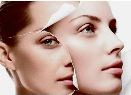 Contraindication process of laser rejuvenation of the face