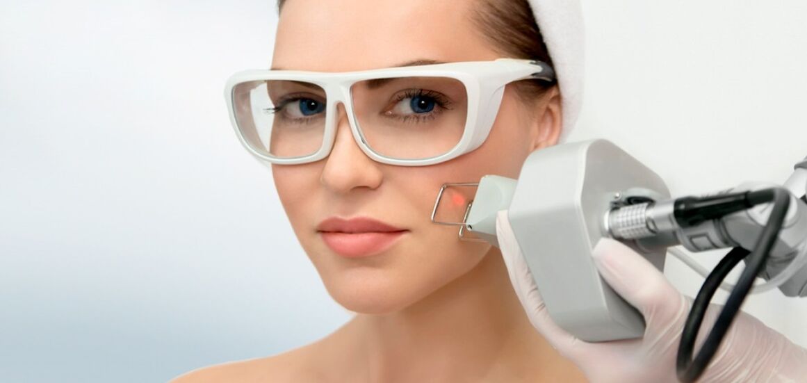 Fractional laser skin resurfacing