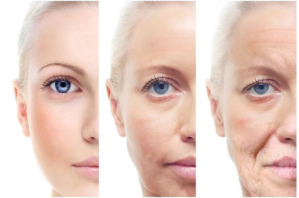 Laser removal of age -related facial changes