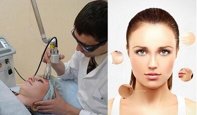 How is laser skin rejuvenation performed