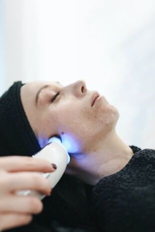 Laser facial skin rejuvenation