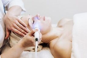 Carrying out fractional skin rejuvenation