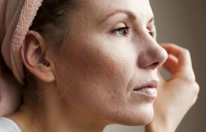 Problematic facial skin in need of anti-aging treatments